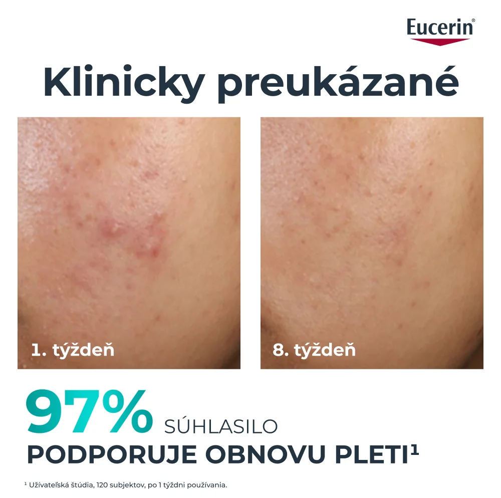 EUCERIN DERMOPURE CLINICAL 10%PEELING 40ML 40 ml