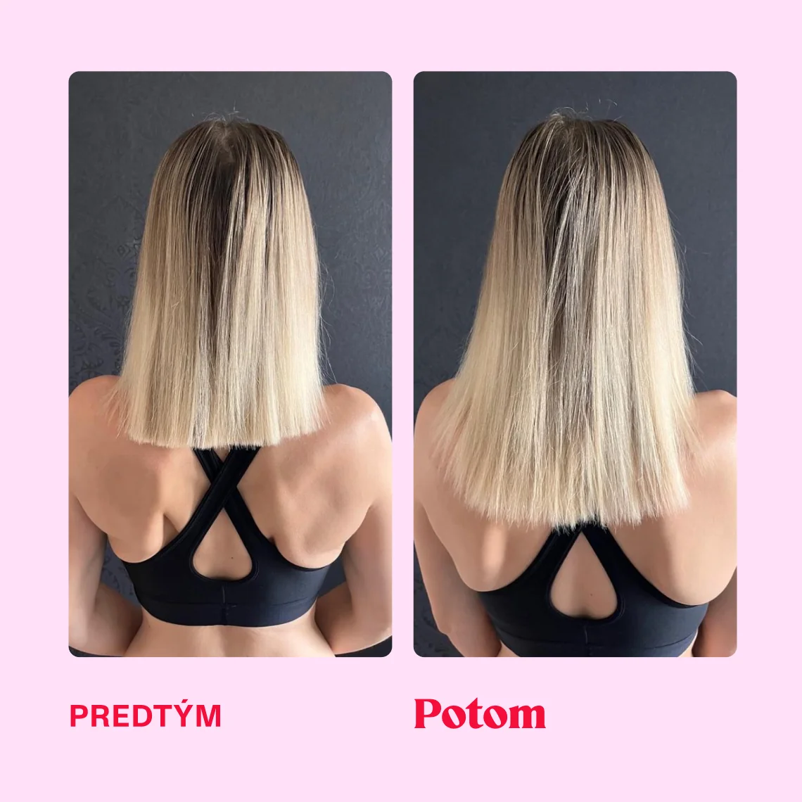 LOVE is in the HAIR - Healthy hair gummies 1×60 ks, výživový doplnok