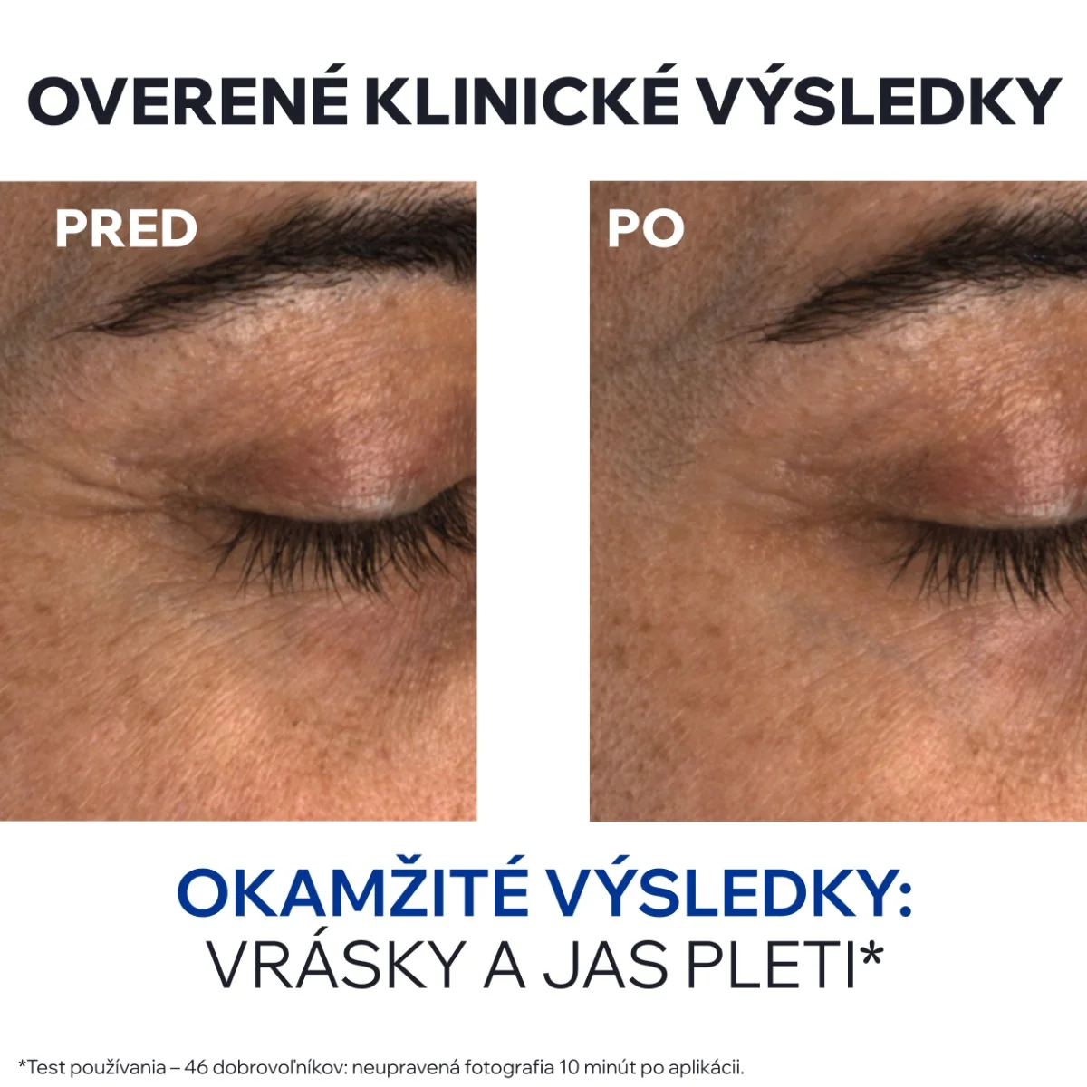 URIAGE AGE ABSOLU Eye Balm 1x15 ml, spevňujúci balzam na očné okolie