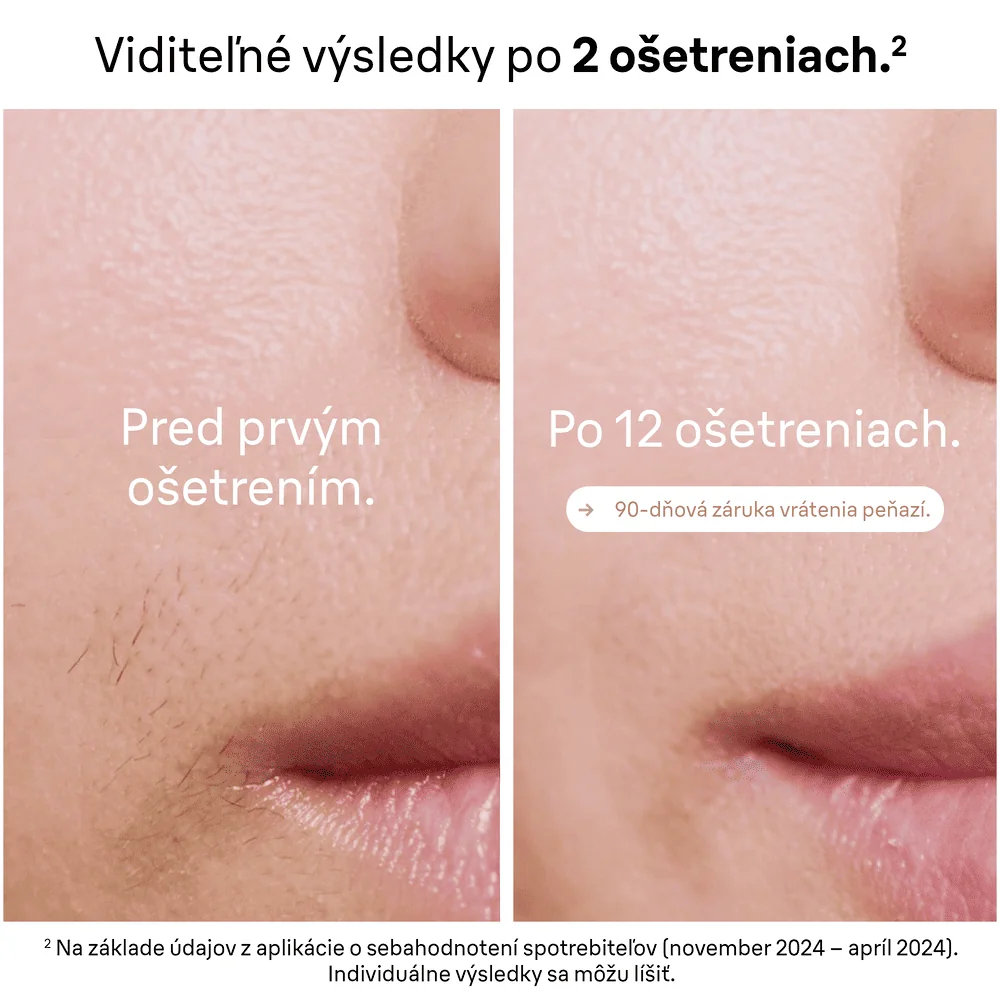 Braun IPL Silk·expert Pro 5, odstraňovanie chĺpkov v pohodlí domova, s puzdrom, 2 hlavy, PL5146 1 ks
