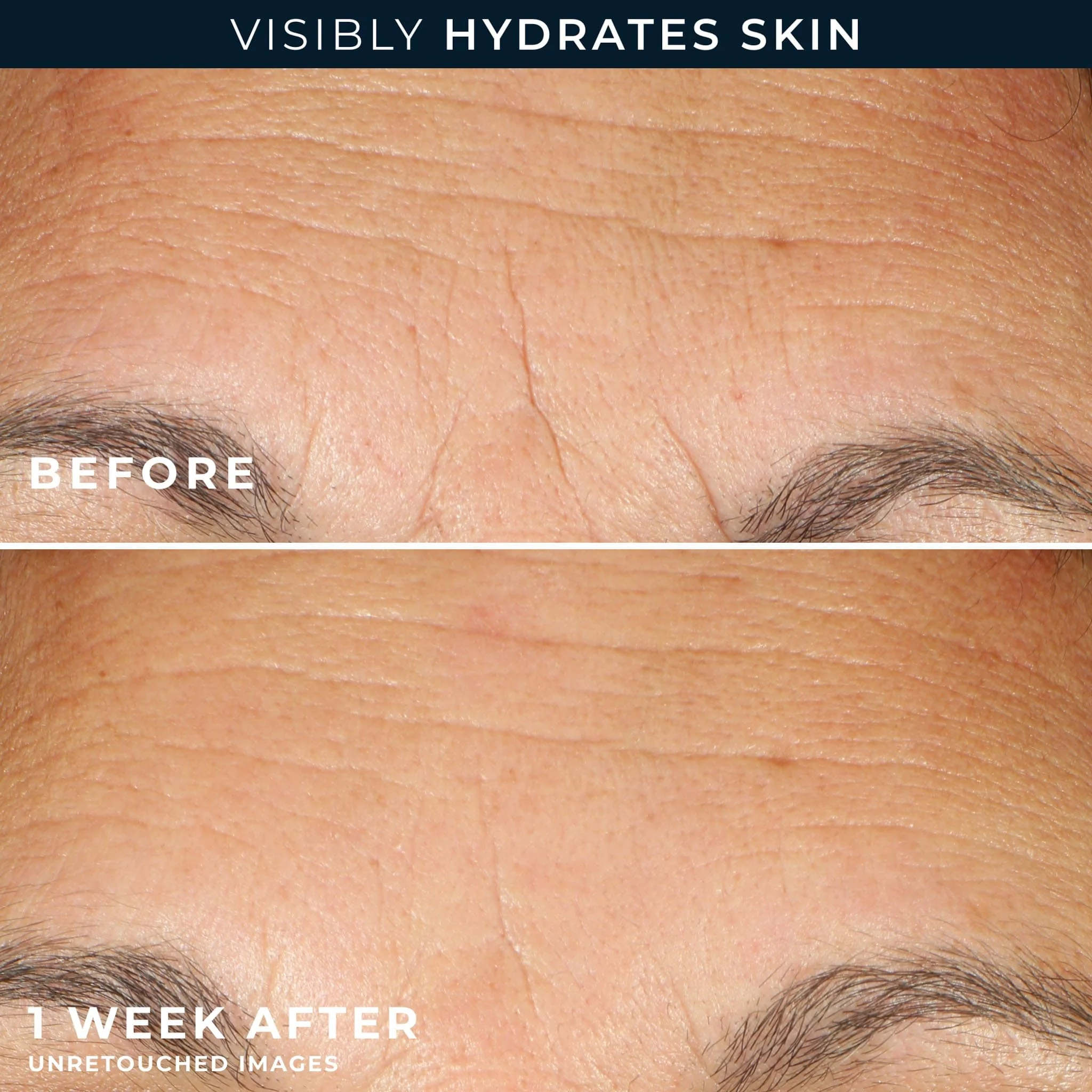 RoC Multi Correxion Hydrate + Plump hydratačné kapsuly, 30 ks 30 ks