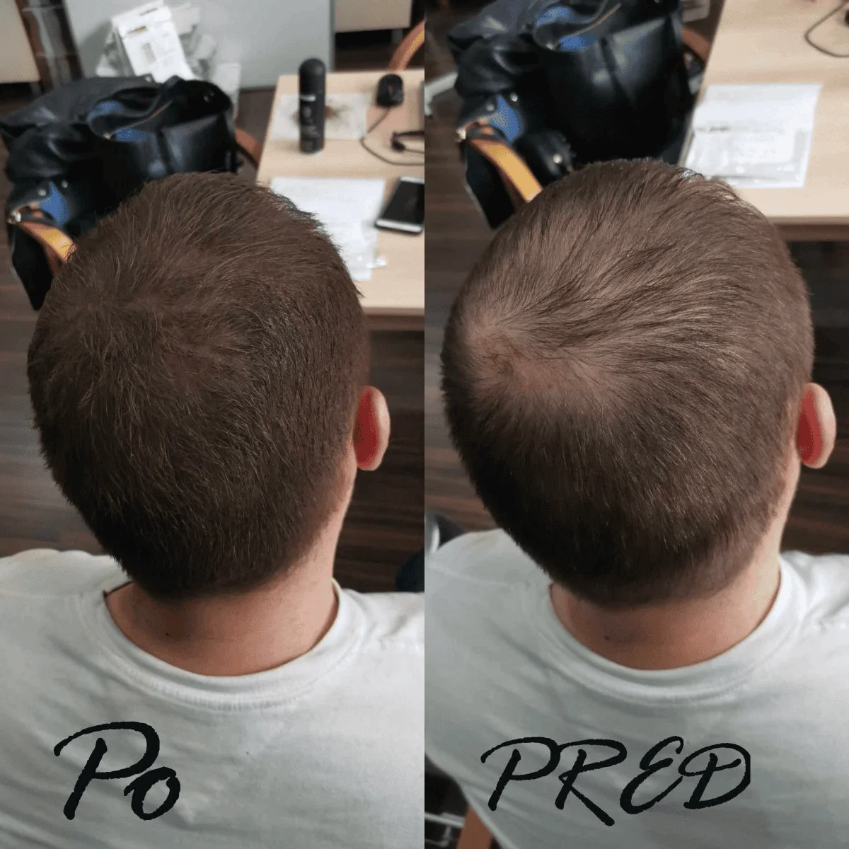 Zahusťovač pre okamžité zahustenie vlasov + FIXÁTOR Svetlo hnedá (Light Brown)