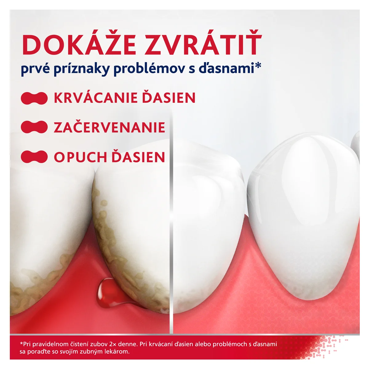 PARODONTAX FLUORID so stéviou 1×75ml, zubná pasta