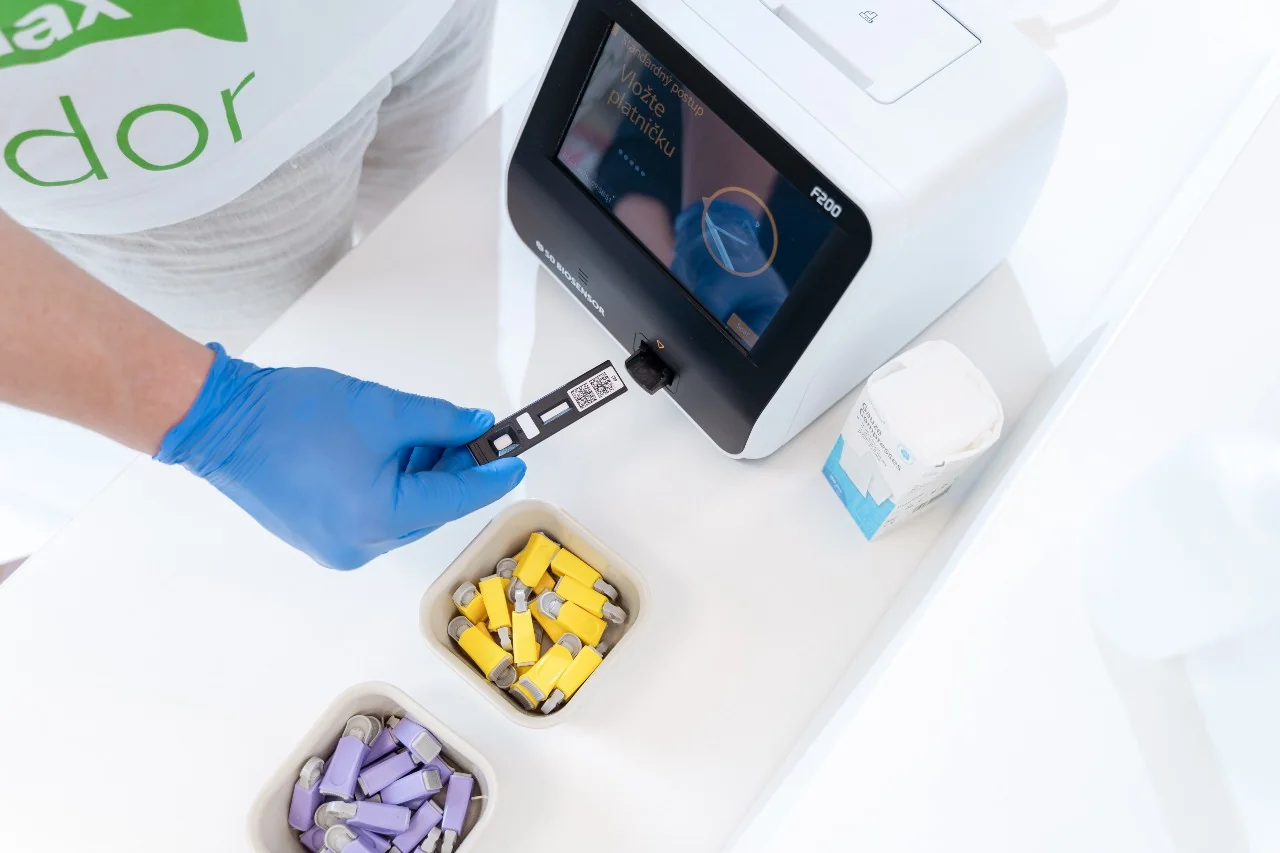 CRP test: Kedy ho potrebujete, čo ukáže a ako znížiť vysoké hodnoty?