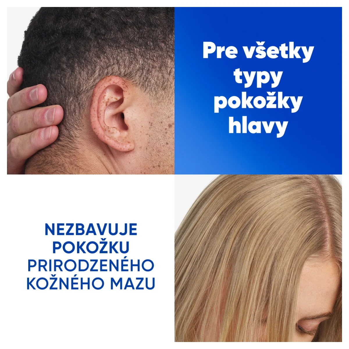 H&S SHP CITRUS FRESH MASTNE VLASY 800ML 1×800 ml, šampón proti lupinám