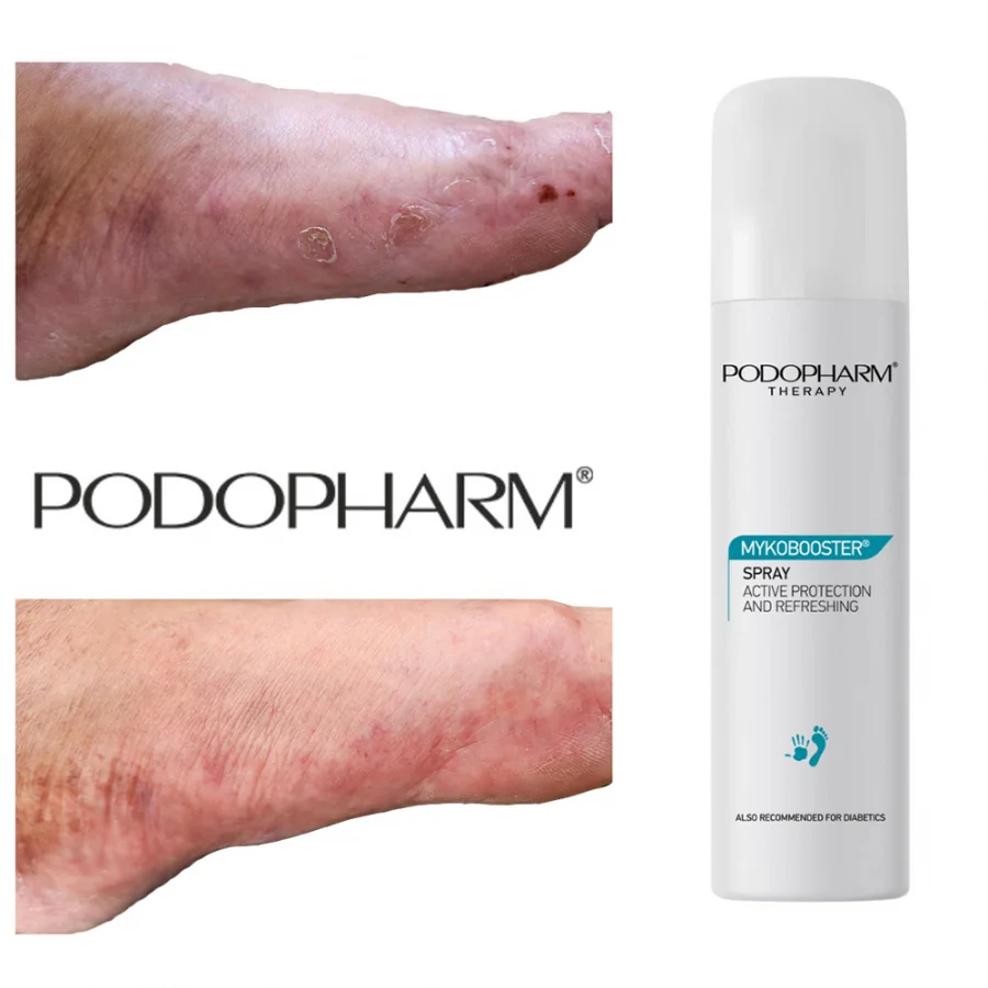 Podopharm Mykobooster – Antimykotický ochranný sprej na nechty a pokožku 125 ml