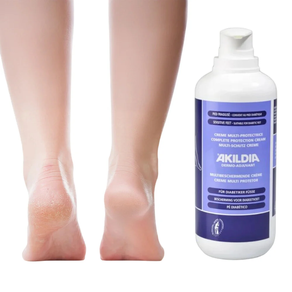 Ochranný krém na nohy pre diabetikov, Akildia Pro - 500 ml