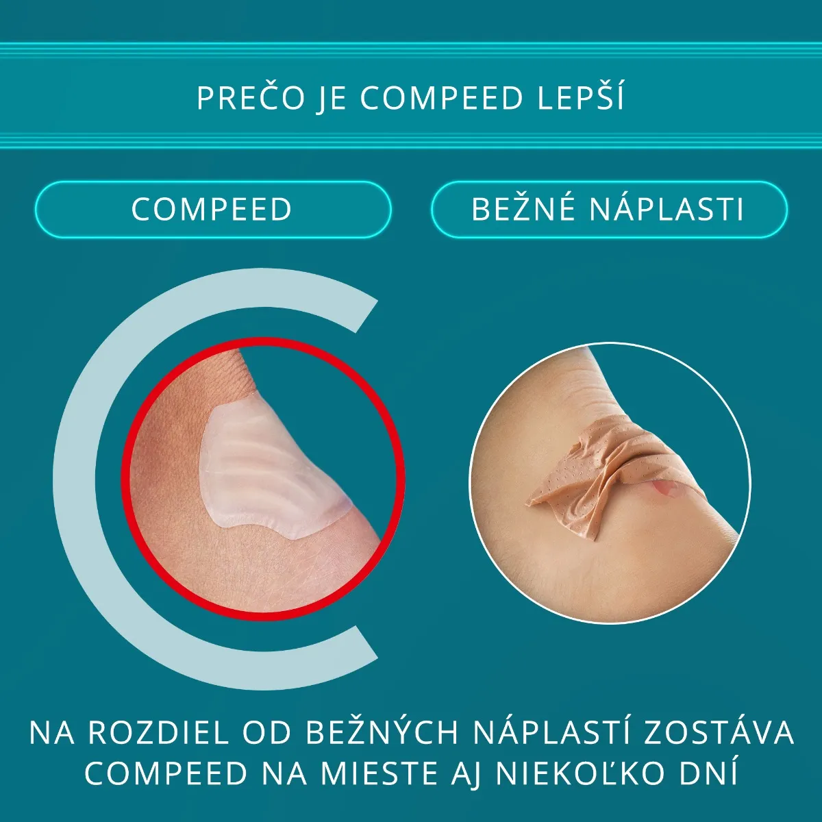 Compeed NÁPLASŤ na pľuzgiere 1×5 ks, stredná, gélová