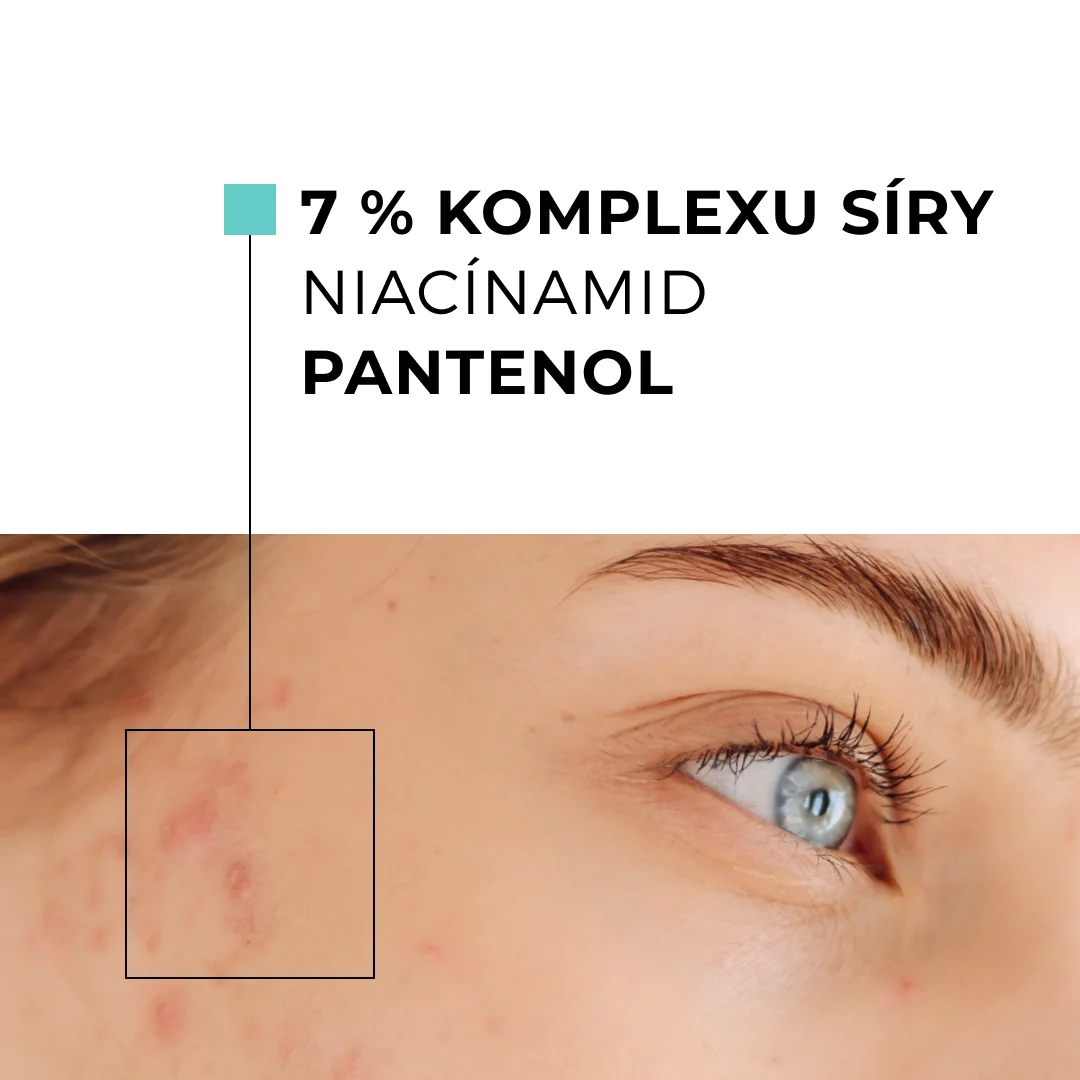 Skinexpert by Dr. Max® ACNEPRO Spot Treatment 1×15 ml, lokálne ošetrenie nedokonalostí pleti