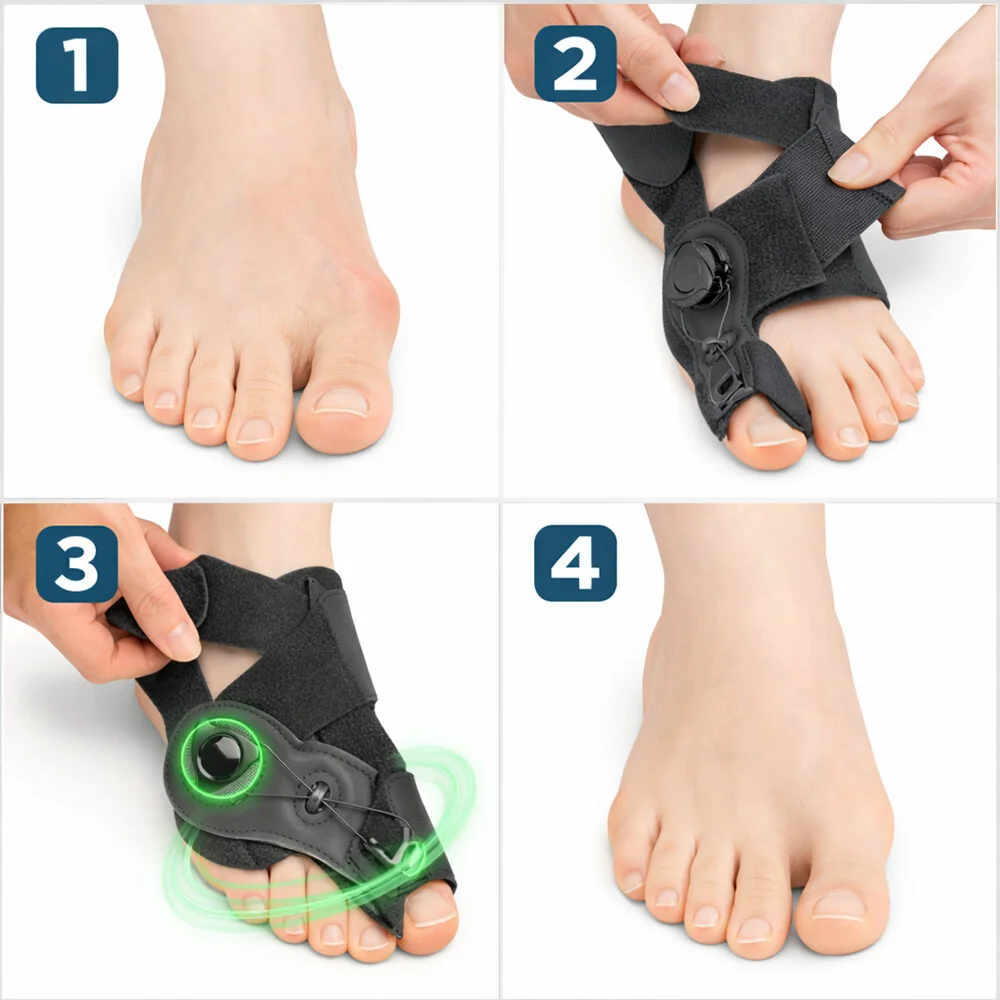 Regulovateľný korektor na Hallux Valgus - Ľavá