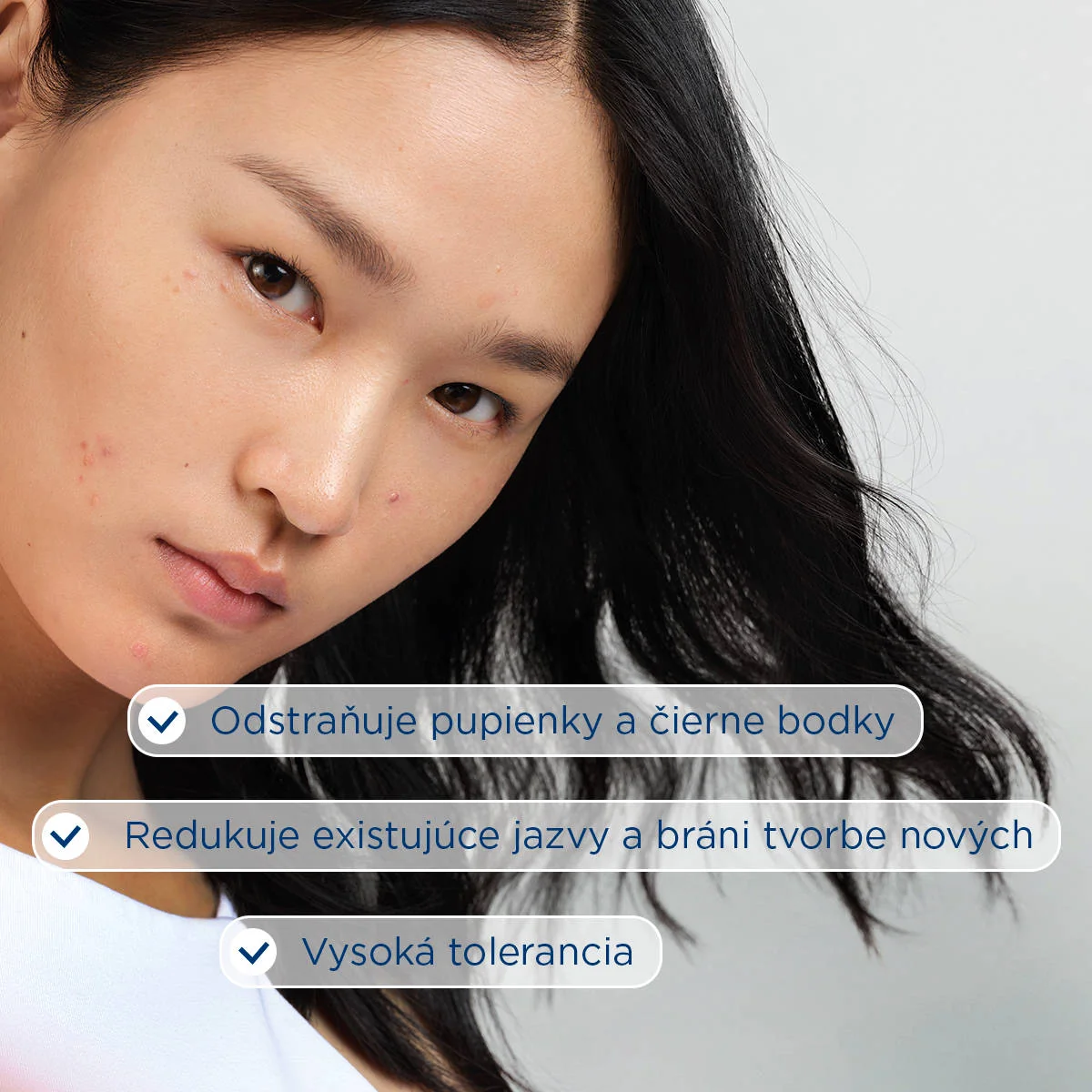 BIODERMA Sébium Kerato+ gél-krém na akné s vysokou toleranciou 1×30 ml, pleťový krém