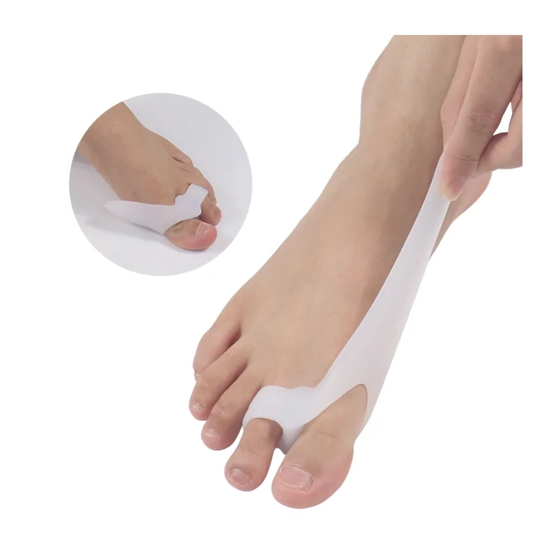 Korektor Hallux Valgus s návlekom 2 ks