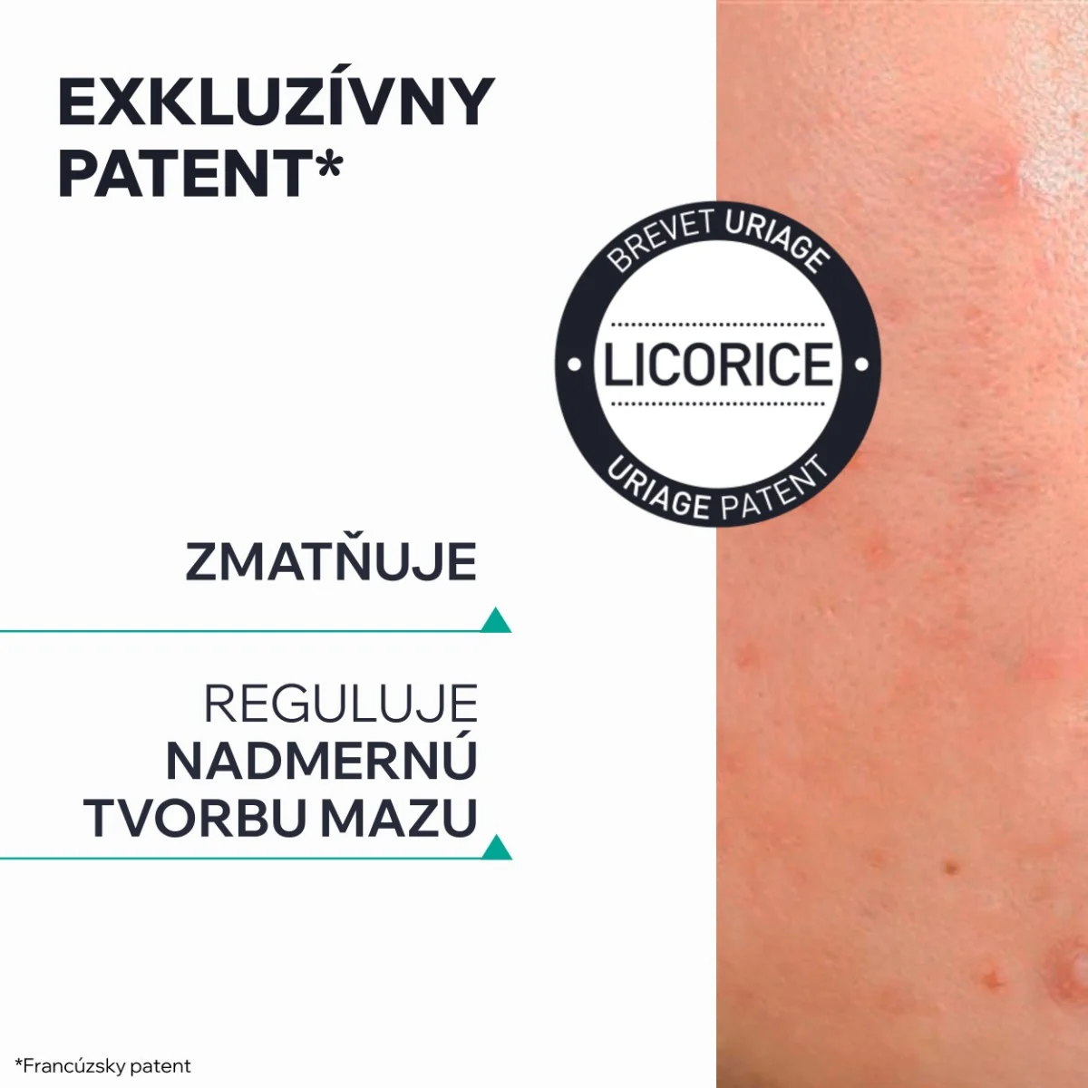 URIAGE HYSEAC 3-Regul+ 1×40 ml, denný krém pre pleť s nedokonalosťami