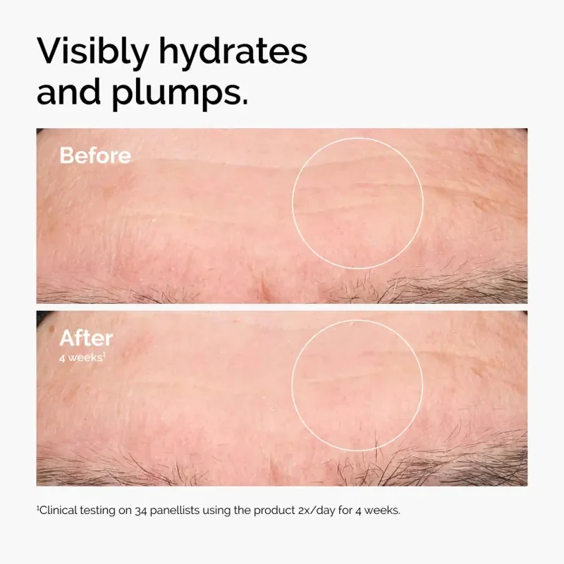 THE ORDINARY - Kyselina Hyalurónová 2% + B5 - nová verzia - hydratačné sérum 30ml