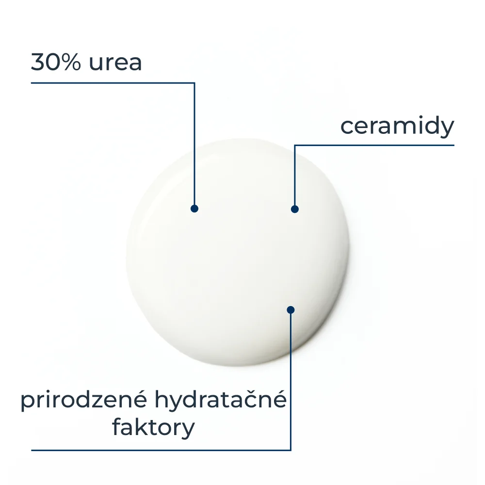 EUCERIN UreaRepair Krém na lokálne použitie 30 % urea, 75 ml 1×75 ml, na lokálne použitie, extrémne suchá pokožka