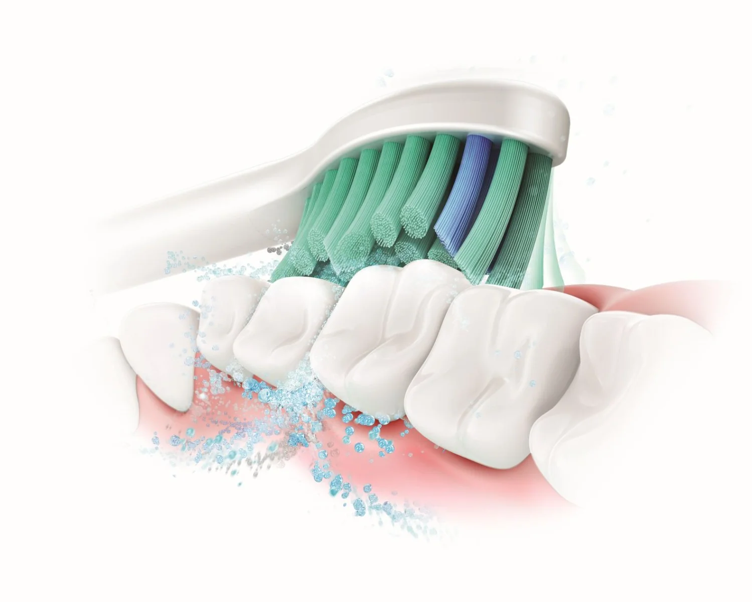 Philips Sonicare 3100 HX3671/14, čierna 1×1 ks, elektrická zubná kefka