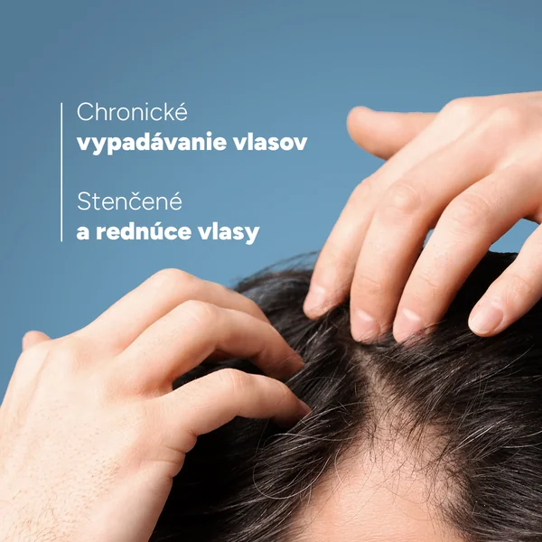 DUCRAY ANAPHASE Šampón 200 ml