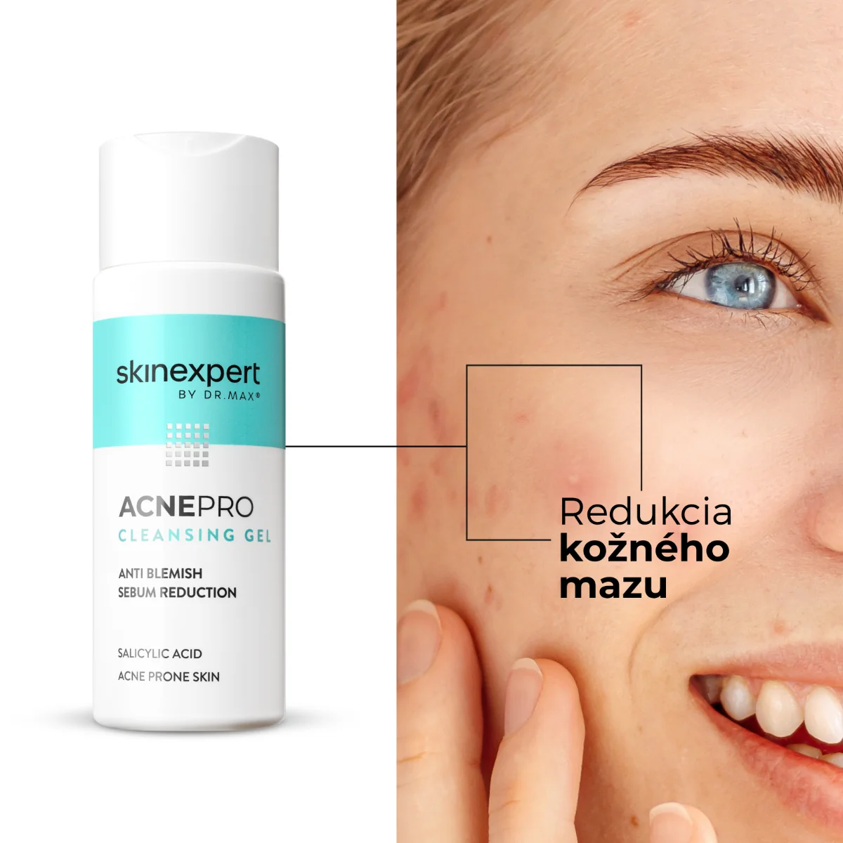 Skinexpert by Dr. Max® ACNEPRO Cleansing Gel 1×200 ml, čistiaci gél proti nedokonalostiam
