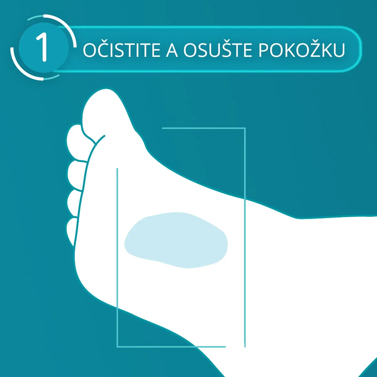 Compeed NÁPLASŤ na mozole 1×6 ks, náplasť, na mozole