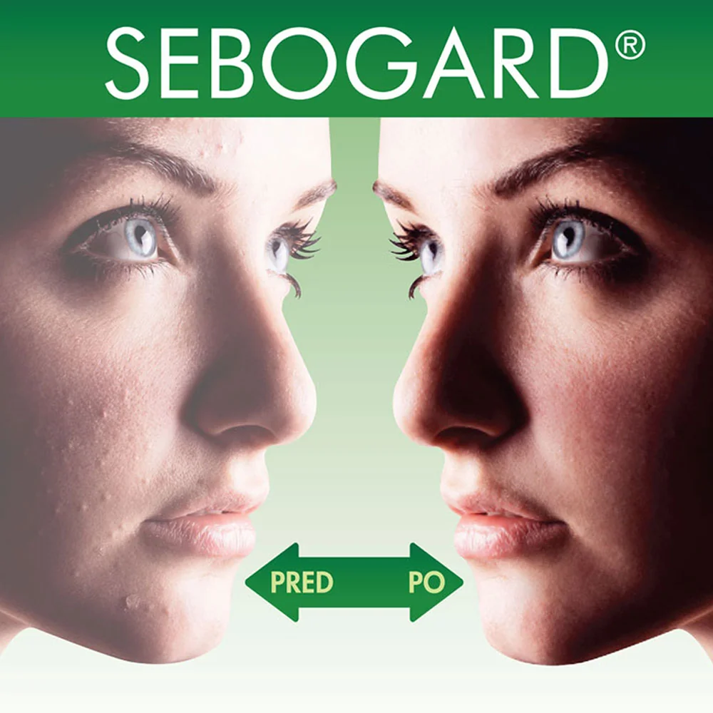 SEBOGARD oral 30 ks