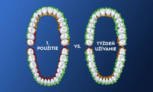 Oral-B 1. použitie vs týždeň používania Oral-B 1. použitie vs týždeň používania