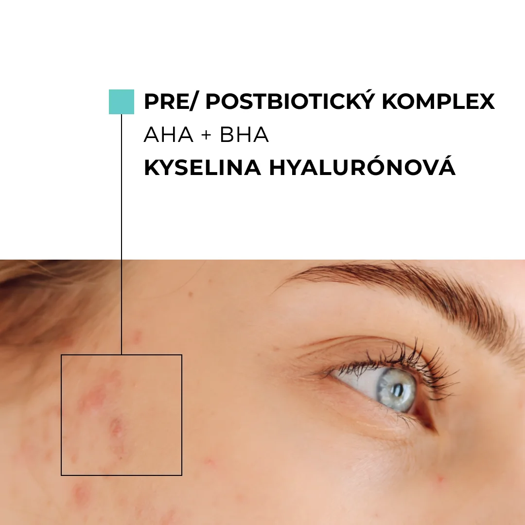 Skinexpert by Dr. Max® ACNEPRO Face Serum 1×28 ml, sérum na tvár proti nedokonalostiam