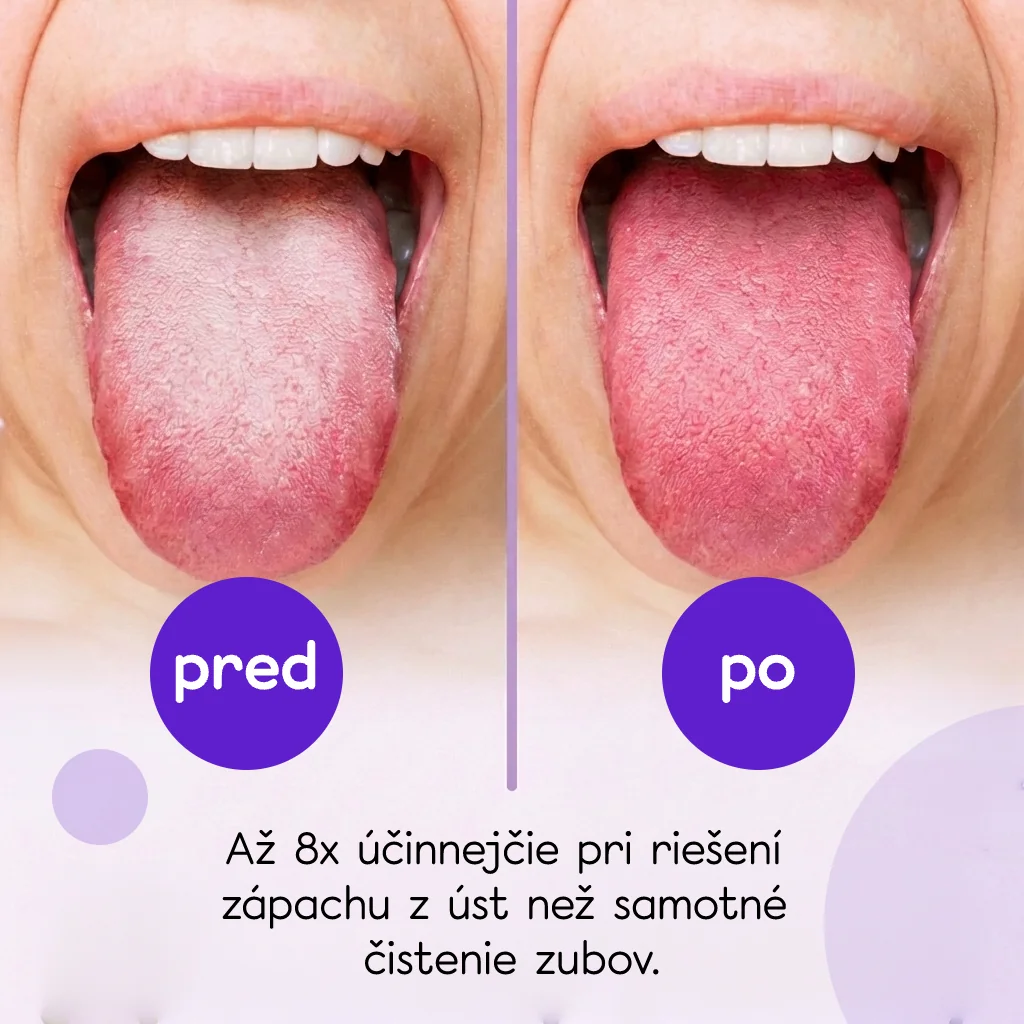 Hello coco Škrabka na jazyk 5 ks