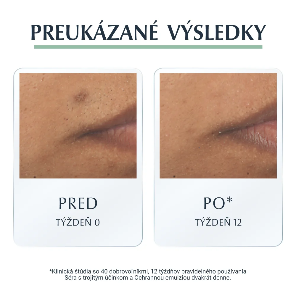 Eucerin DERMOPURE Emulzia SPF30 ochranná, problematická pleť 1x50 ml