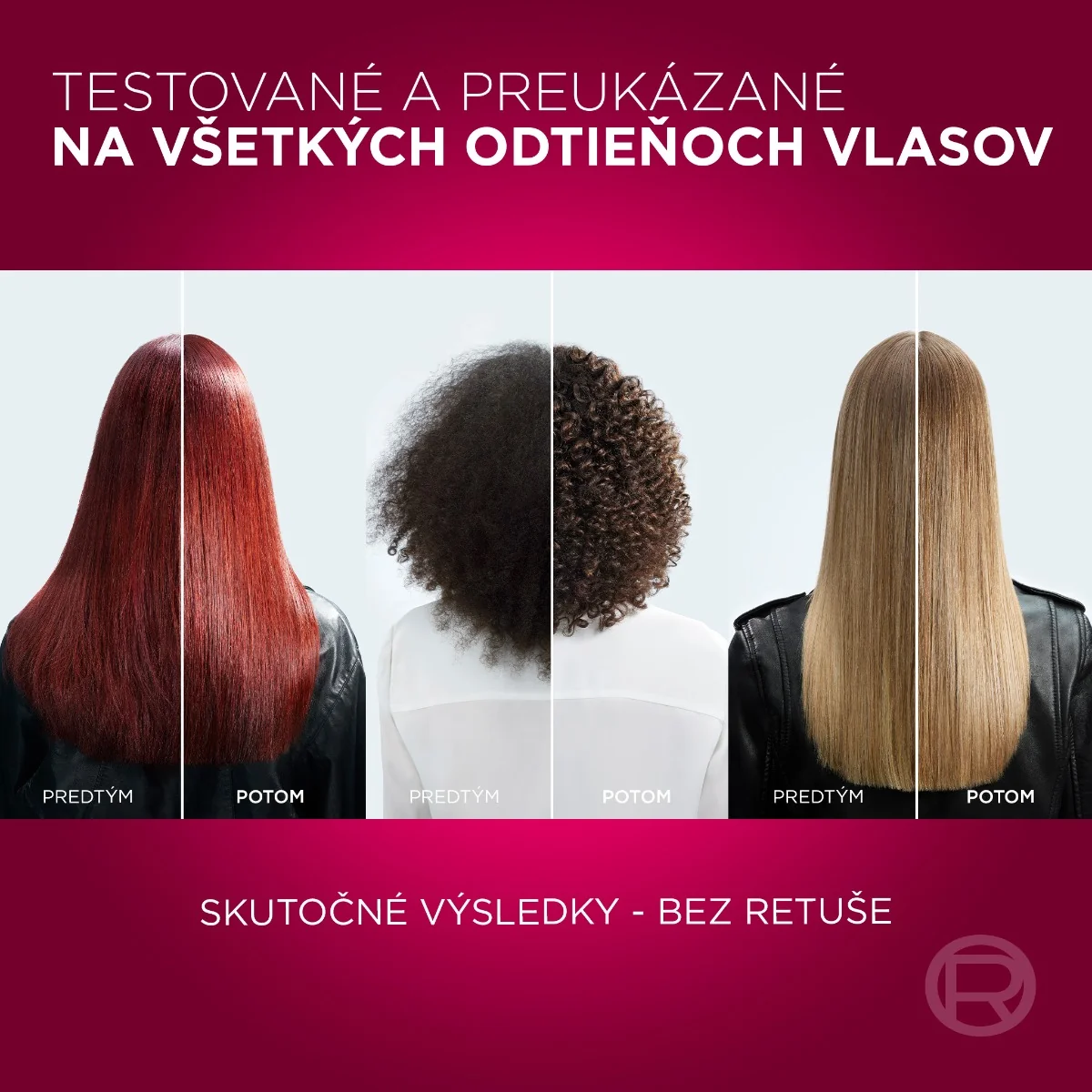 L'Oréal Paris Elseve Color Vive šampón 1×250 ml, šampón na farbené vlasy