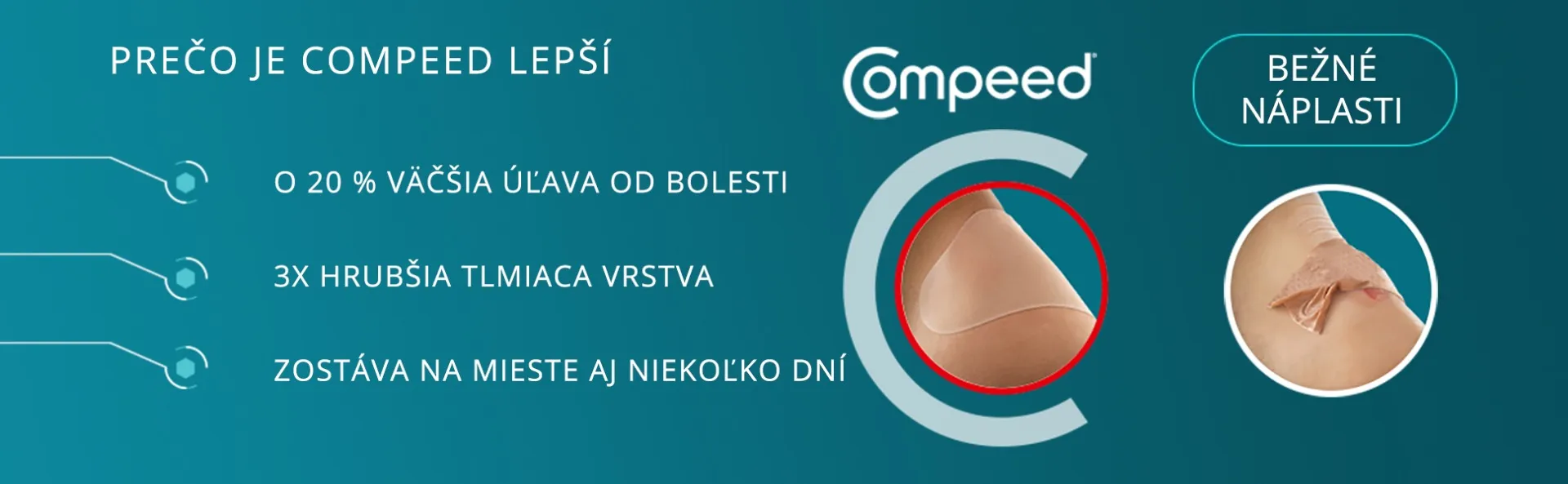 Compeed NÁPLASŤ na pľuzgiere MIX 1×5 ks, náplaste MIX