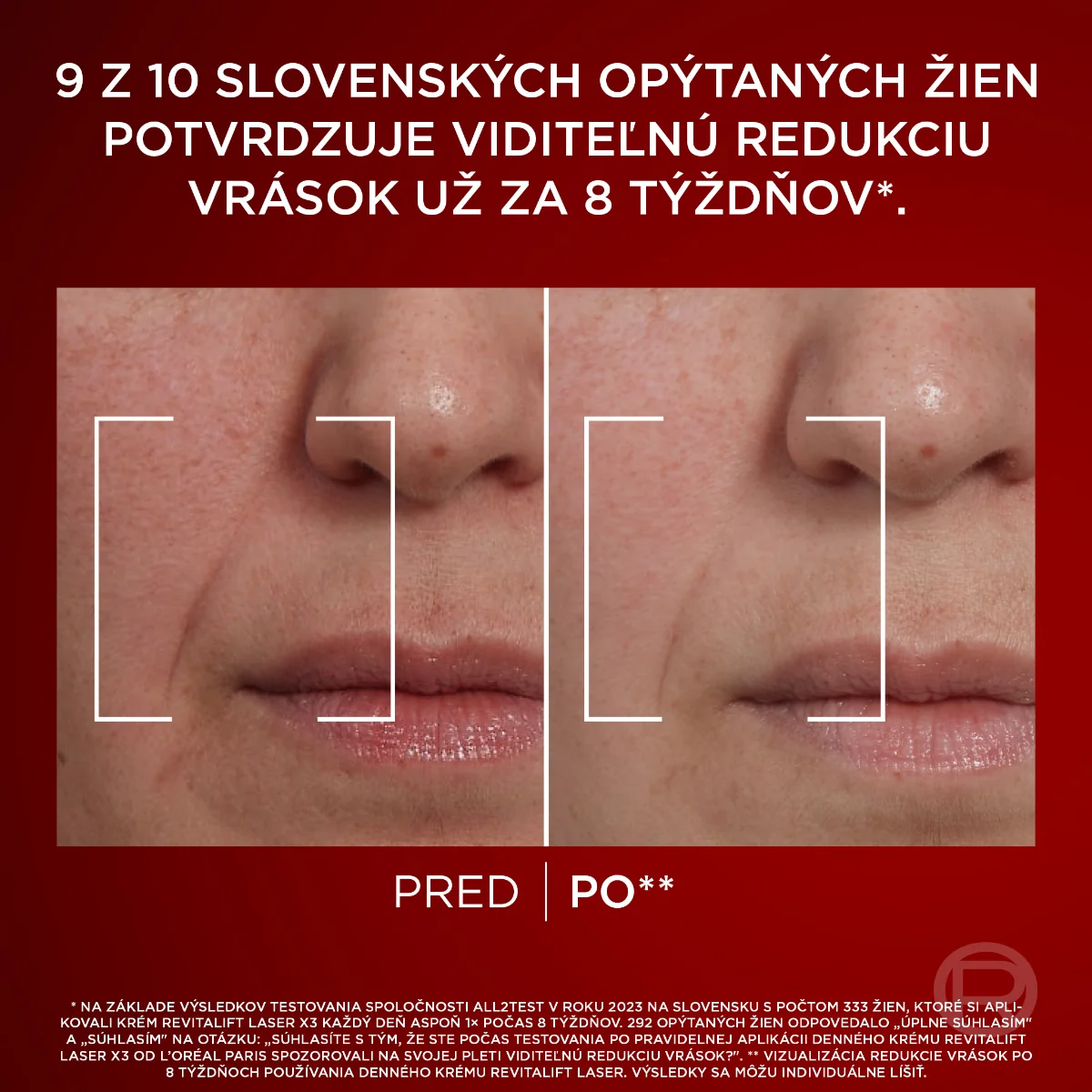 L´OREAL REVITALIFT LASER X3 DENNÝ 1×50 ml, intenzívny krém proti starnutiu pleti