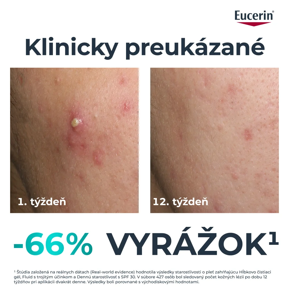 Eucerin DERMOPURE CLINICAL Pleťový fluid s trojitým účinkom 40 ml