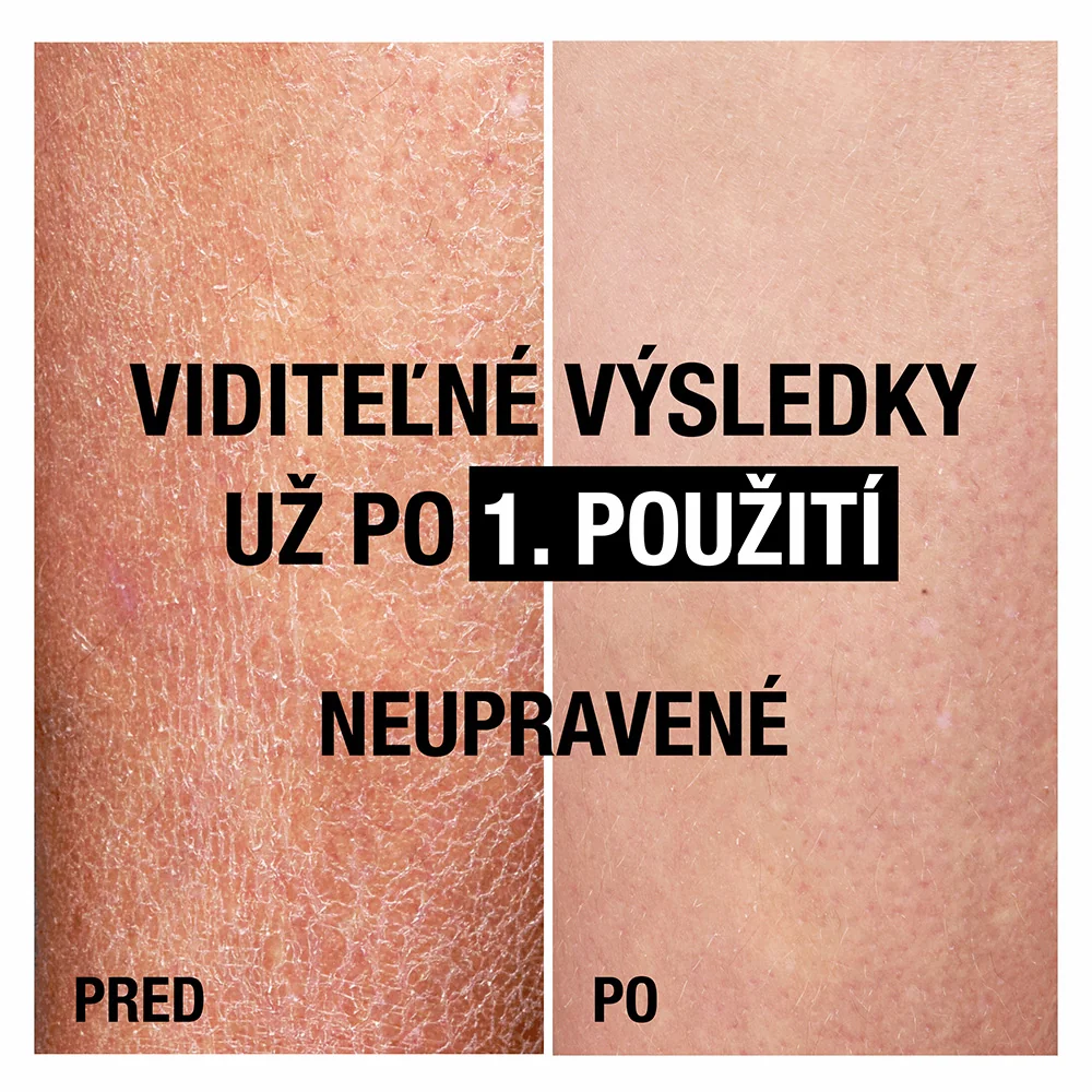 NEUTROGENA® Hĺbkovo hydratačné telové mlieko na citlivú pokožku s Nórskou receptúrou 1×400 ml, hydratačné telové mlieko