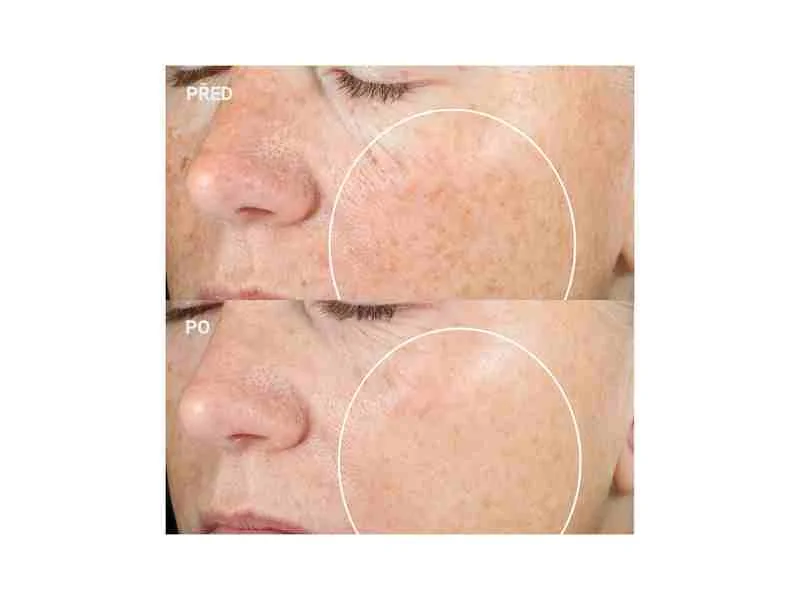 StriVectin Super-C rozjasňujúce sérum s retinolom a vitamínom C 1×30 ml, rozjasňujúce sérum