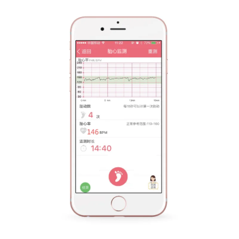 ANGELSOUND JPD-100S+ prenatálny odposluch Bluetooth
