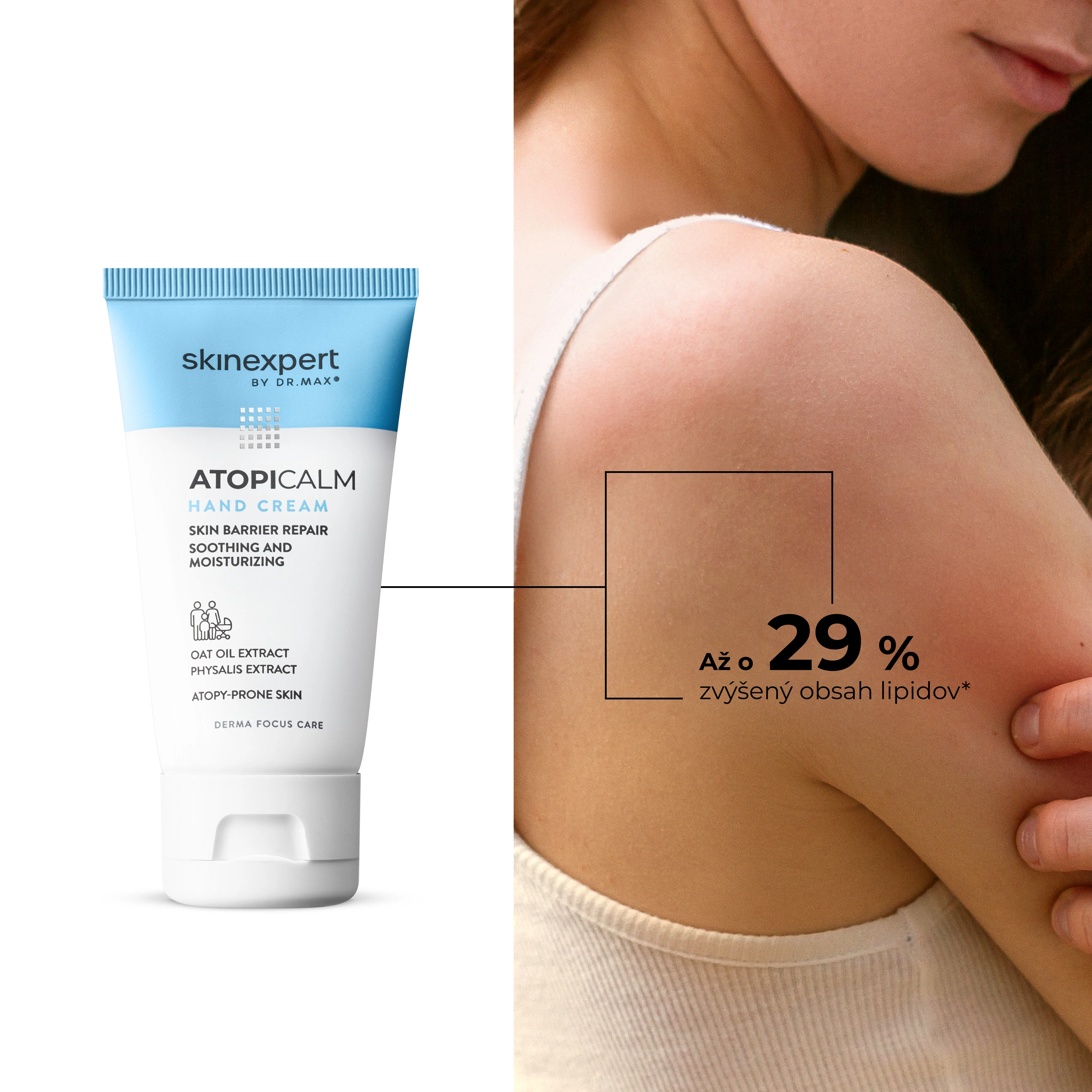 Skinexpert by Dr. Max® ATOPICALM Hand Cream 1×50 ml, krém na ruky