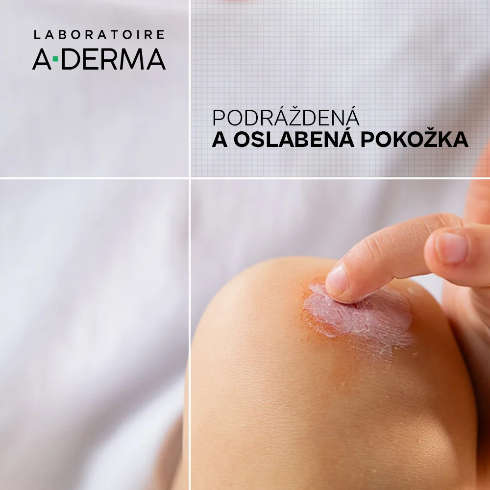 A-DERMA DERMALIBOUR+ BARRIER 100 ml 1×100 ml, ochranný krém