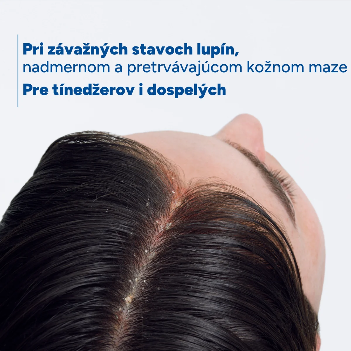 DUCRAY KELUAL DS SEBOCONTROL Šampón 100 ml
