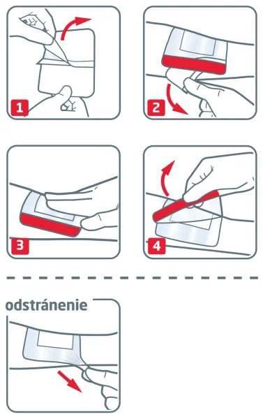 Leukoplast® Leukomed® T plus absorpčná náplasť na rany, vodeodolná, 5x7,2 cm, 1x5 ks