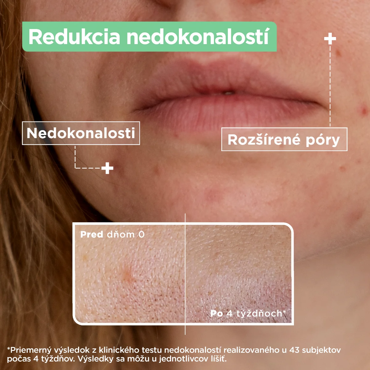 Mixa Sensitive Skin Expert sérum proti nedokonalostiam 1×30 ml, sérum