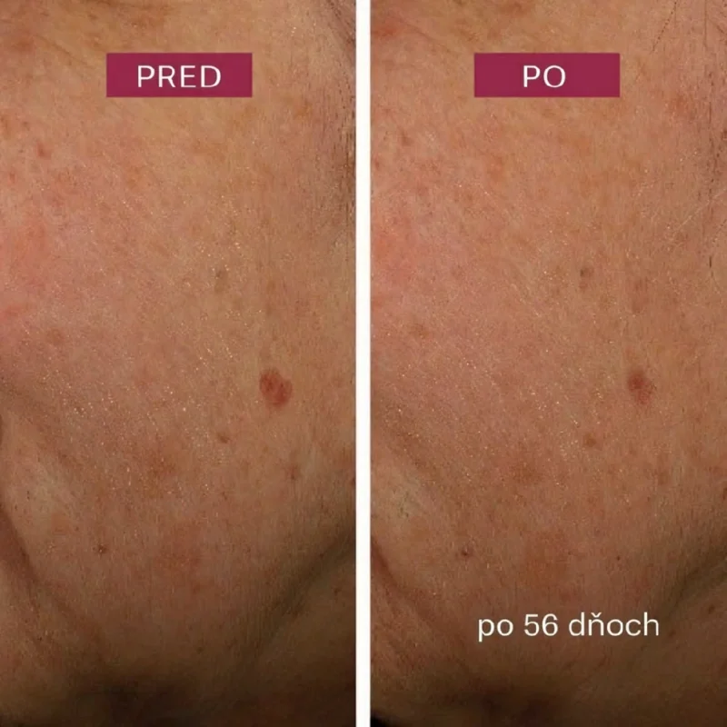 Pleťové sérum Dark Spot