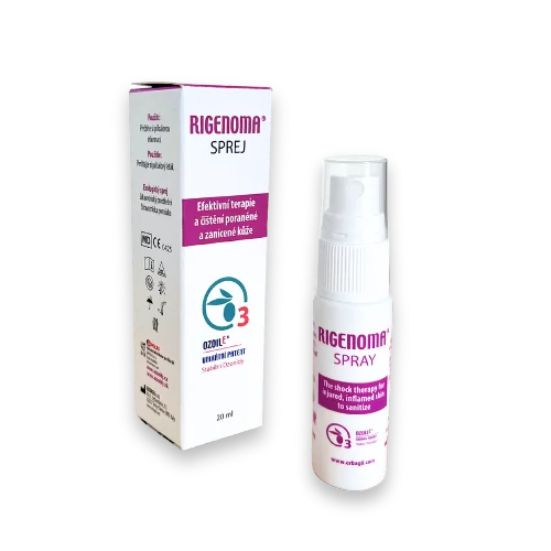 RIGENOMA® bioaktívny sprej na rany 1×20 ml, zdravotnícka pomôcka