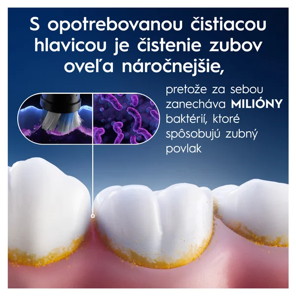 Oral-B iO Series Radiant White náhradné hlavice pre bielenie zubov, čierne 4 ks