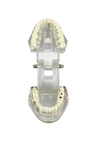Model chrupu, zubných implantátov transparentný