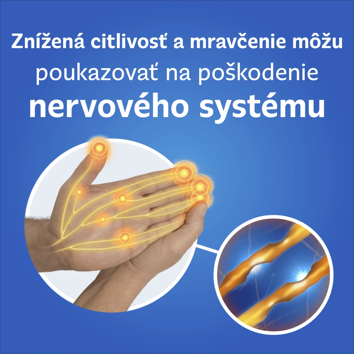 NEUROBION 100 mg/50 mg/1 mg 30 filmom obalených tabliet 1×30 tbl, liečivo