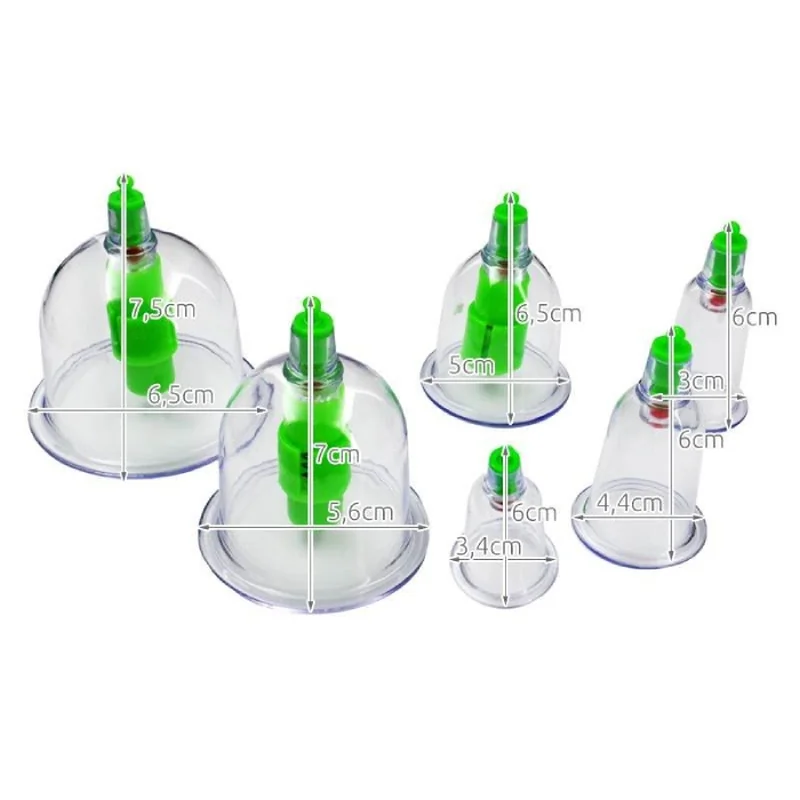 MG Cupping Therapy vákuové banky 12ks