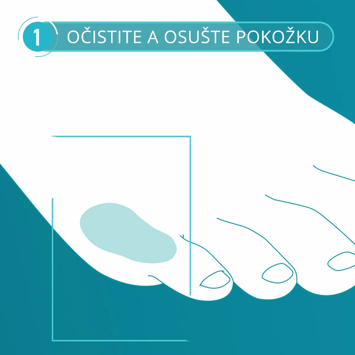 Compeed Náplasť na kurie oká MOIST 1×6 ks, na kurie oká