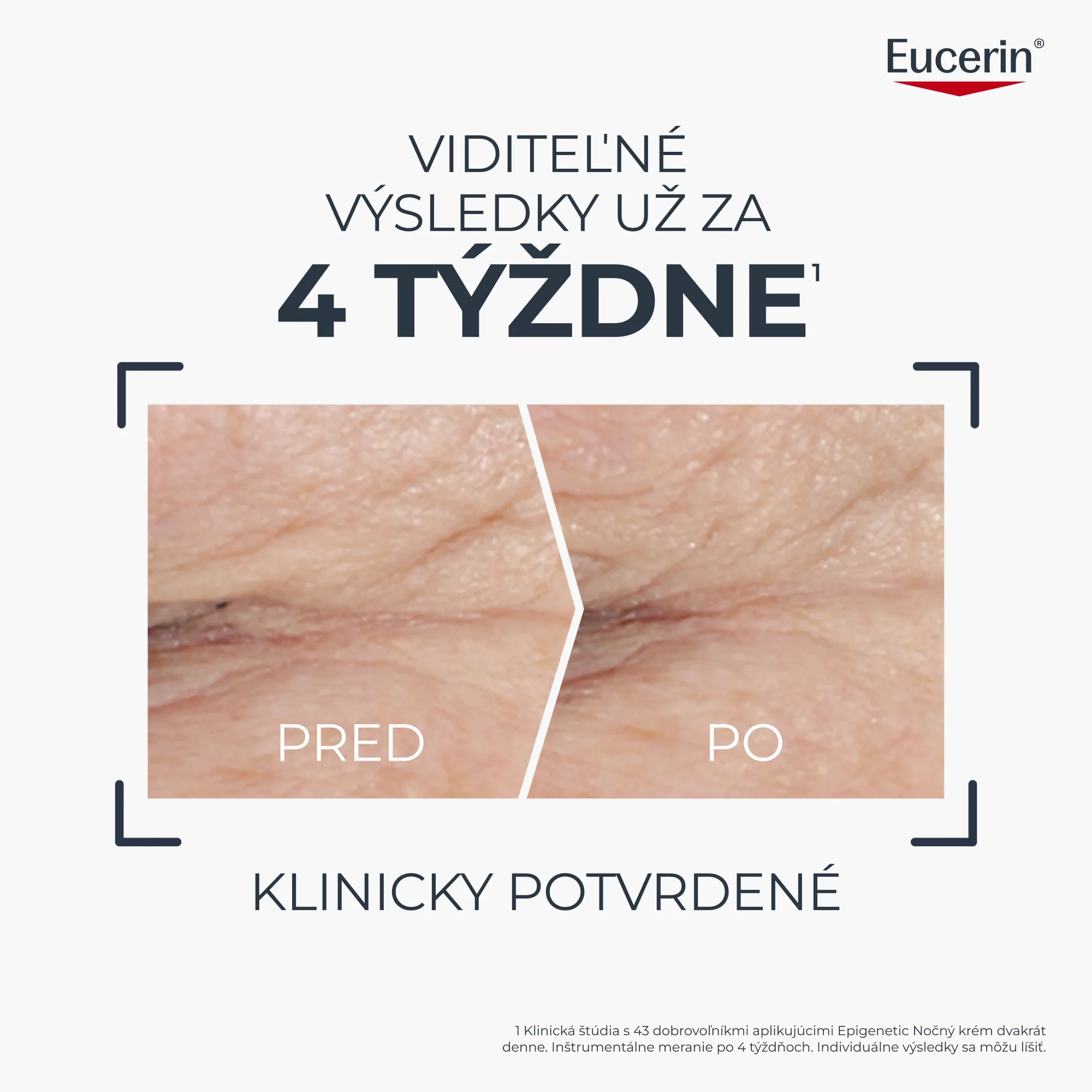 Eucerin HYALURON-FILLER + LONGEVITY EPIGENETIC Nočný krém 50 ml