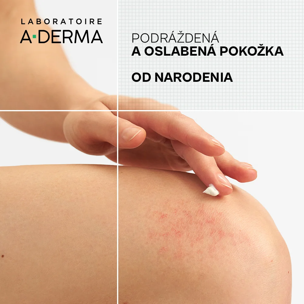 A-DERMA DERMALIBOUR+ Reparačný CICA-Krém 1x50ml, CICA krém
