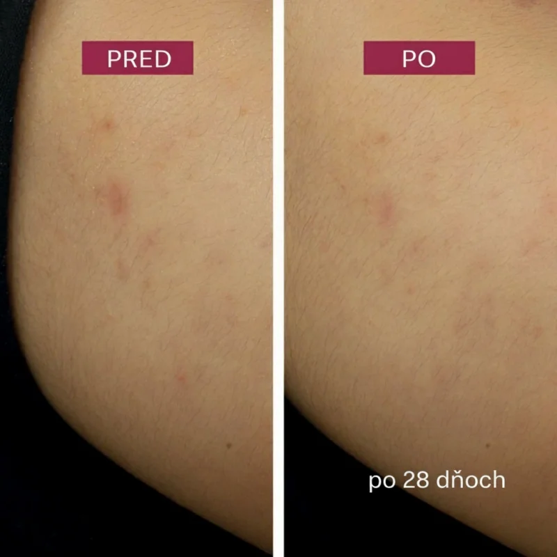 Nočný krém Dark Spot